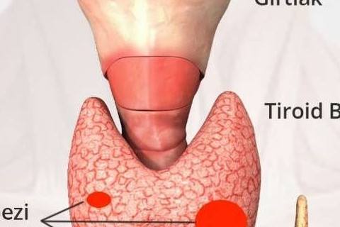 ödenen damlaların tiroid bezi üzerindeki etkisi